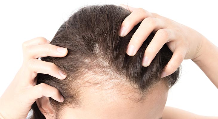 Best Ayurvedic Hair Loss Treatment In Thane (Call:9513500146) | Hair Loss  Treatment In Thane West
